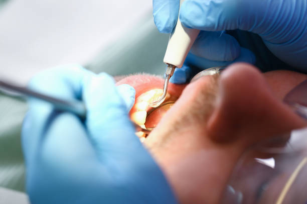 Professional Emergency Dental Service in WA