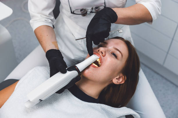 Best Emergency Wisdom Tooth Extraction in Riverbend, WA